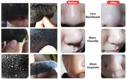 Sadoer 10 pcs Bamboo Charcoal Nose Strip Cleansing Pore Strips Peel Off Nose Sticker Mask Blackhead Remover Nose Strip Black Head Removal Nose Mask